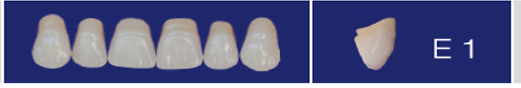 E1 - Set